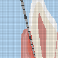 PerioProbe