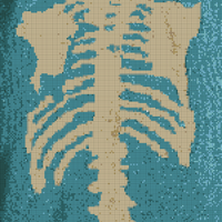 ribcage/spine chart