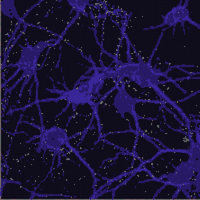 microglia.jpg