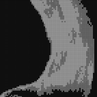 right ovary.jpg