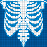 x-ray