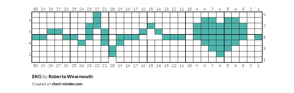 EKG