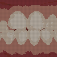 Teeth project